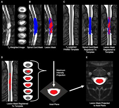 spinal cord toolbox